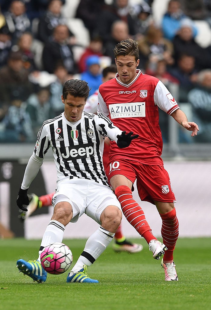 Juventus FC v Carpi FC - Serie A