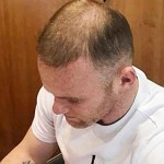 Rooney sta perdendo i capelli - The Sun